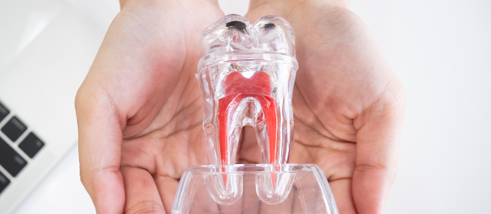 歯を残す治療を選択した場合のメリット・デメリット