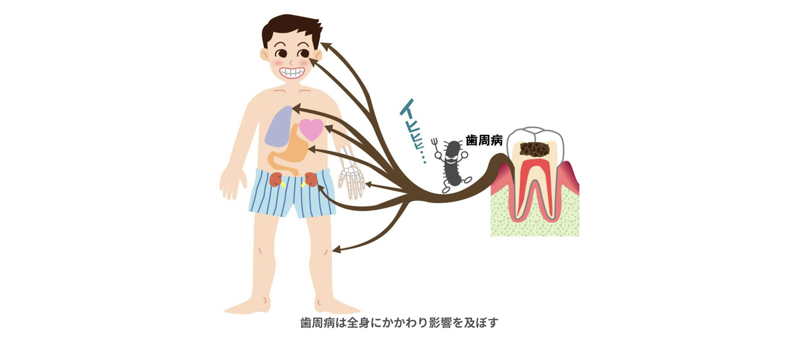 歯周病治療について